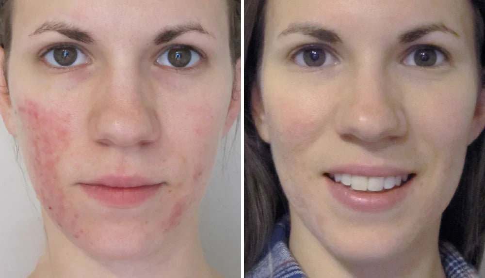 Glowrie Redness Relief Serum