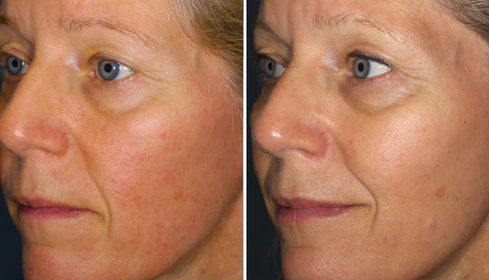 Glowrie Redness Relief Serum
