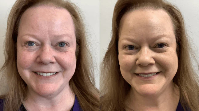 Glowrie Redness Relief Serum